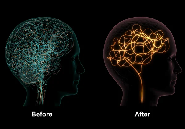 Brain pathways tangled by stress, showing neuroplasticity.